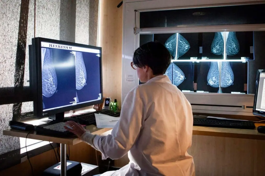 AI-Assisted Mammography Significantly Reduces Aggressive Cancer Development Before Next Screening