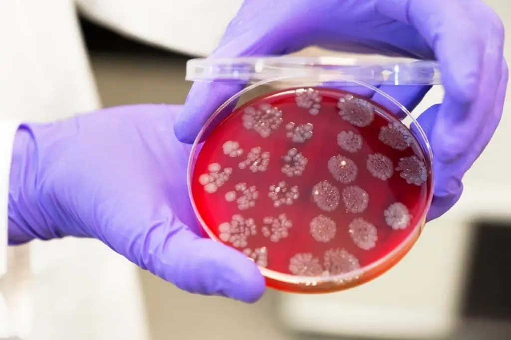 Faecal Transplants Show Promise in Enhancing Kidney Cancer Treatment Through Microbiome Modulation