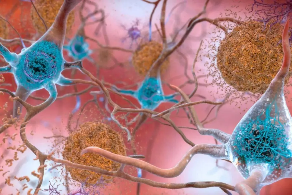 Unlocking Resilience: How Some Brains Resist Alzheimer's Symptoms Despite Disease Markers