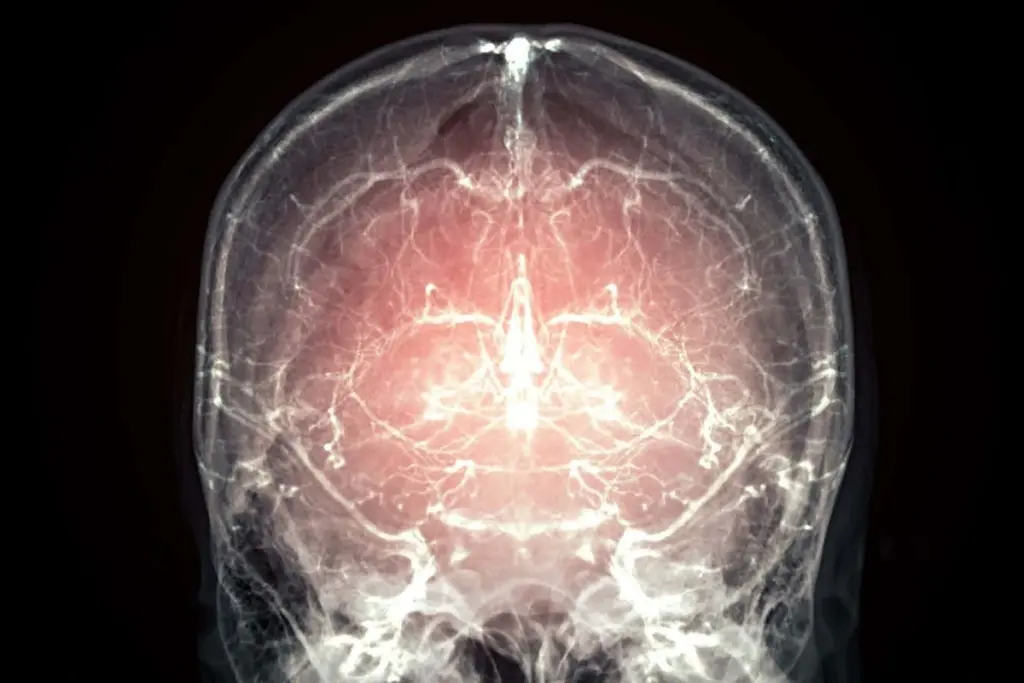 Whole Mammalian Brain Successfully Preserved, Offering Hope for Mind Reconstruction